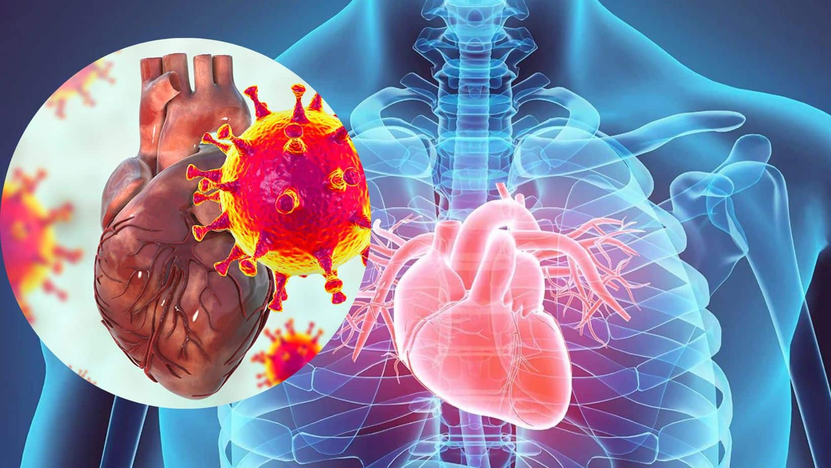 COVID Heart: Chest Discomfort And Other Signs COVID-19 Has Damaged Your Heart